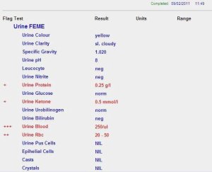 09021011-urinerbcplus